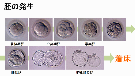 胚盤胞孵化補助(アシステッドハッチング)|山下湘南夢クリニック|藤沢市の不妊治療/体外受精